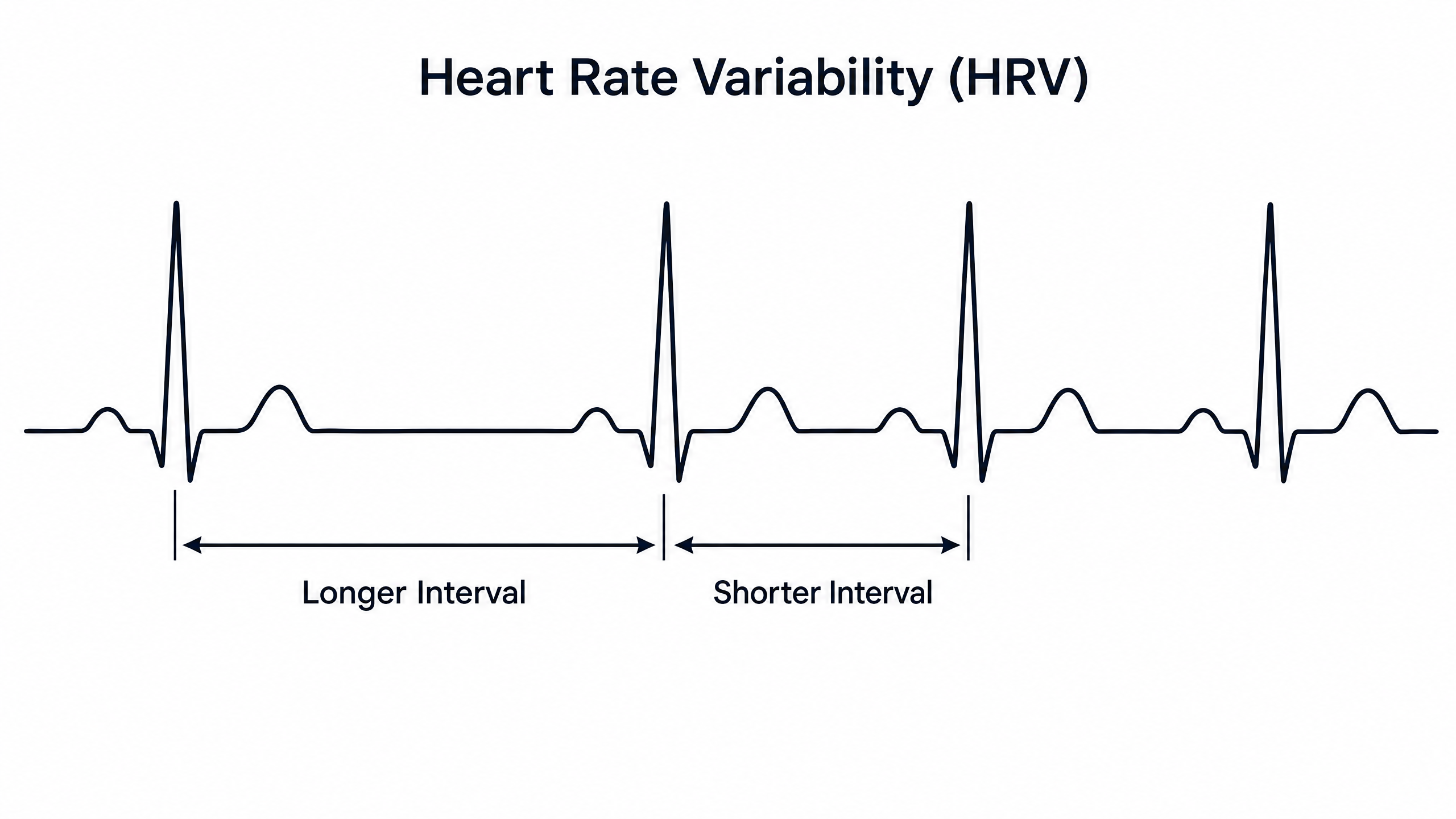 Heart Rate Variability diagram showing longer and shorter intervals between heartbeats